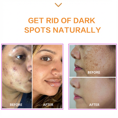 PeptiLift™ Deep Collagen Peptide Lifting Ampoule